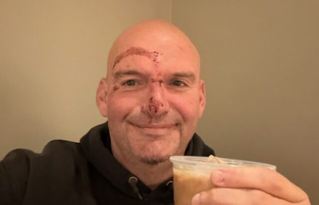 Bloody Faced John Fetterman Celebrates ‘Full Recovery’ In Smiling Picture After Heart Issue Sent Him to the Hospital 2025 Bloody-Faced John Fetterman Celebrates ‘Full Recovery’ In Smiling Picture After Heart Issue Sent Him to the Hospital 2025